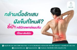 กล้ามเนื้ออักเสบ ฝังเข็มที่ไหนดี? ชี้เป้าคลินิกแพทย์แผนจีนที่ปิยชาติคลินิก